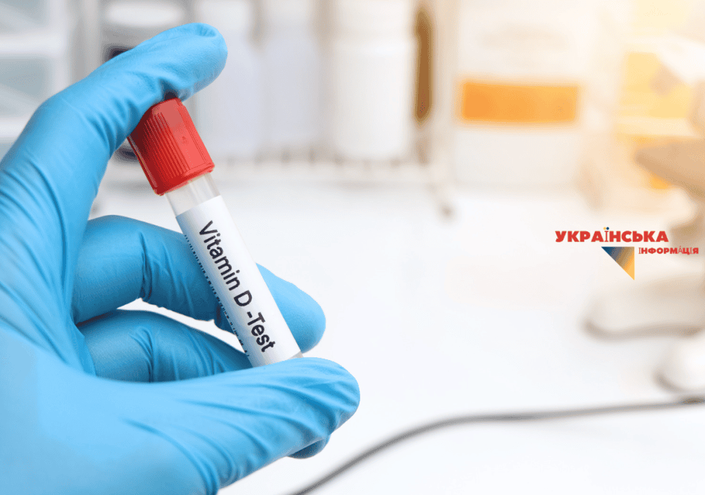 Аналіз крові на 25(OH)D. Джерело: ARC Medical